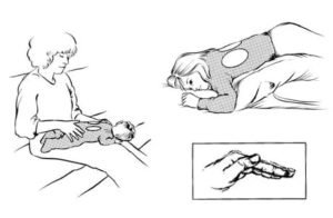 Постуральный массаж