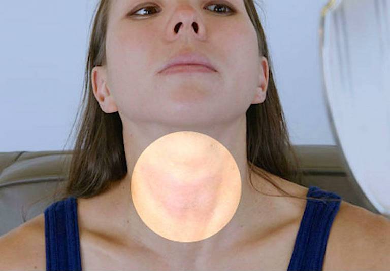 Щитовидная железа, симптомы заболевания у женщин, внешние признаки