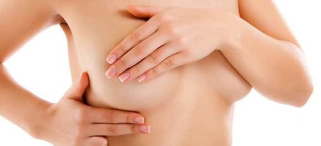 Симптомы и признаки мастопатии молочной железы: способы лечения