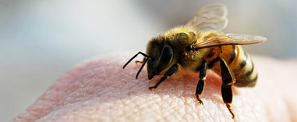 Пчела и ее укус