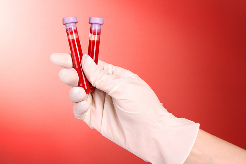 Общий и биохимический анализ крови при аллергическом дерматите